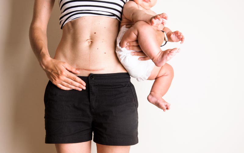 Postnatal recovery tips for women