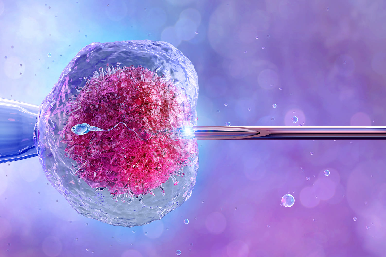 IVF vs IUI