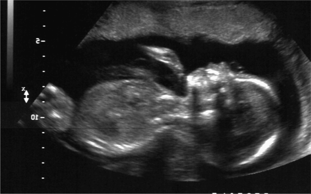 Due Date Calculator Pregnancy Calculator Week by Week Motherhood