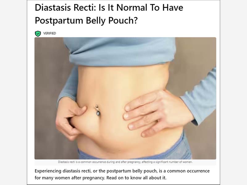 Diastasis Recti: Is It Normal To Have Postpartum Belly Pouch